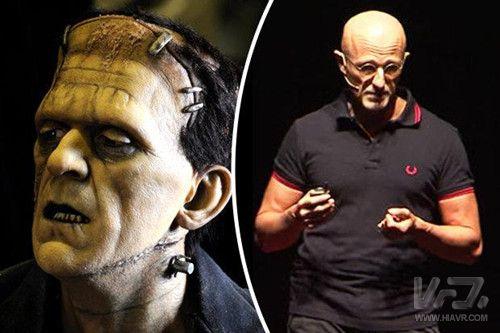 VR医疗｜全球首例“换头手术”成功了么？