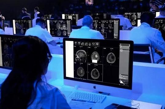 全球首场神经影像人机大赛 BioMind战胜25位医界顶尖专家